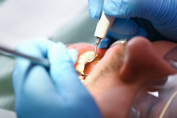 Best Weekend Emergency Dentist in Chapel Hill, TN