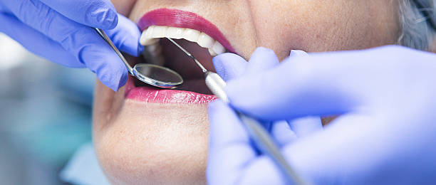 Best After-Hours Emergency Dentist in Chapel Hill, TN