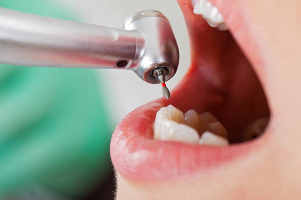 Best Emergency Dental Care for Trauma or Injury in Chapel Hill, TN